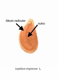 Lobulo radicular 1
